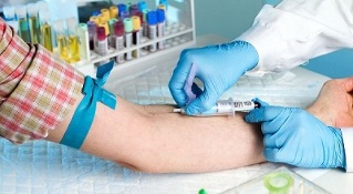 fumare e fare un esame del sangue da una vena